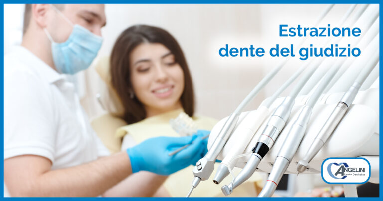 Estrazione dente del giudizio 1