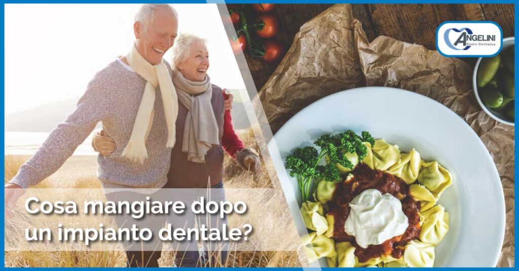 cosa mangiare dopo un impianto dentale