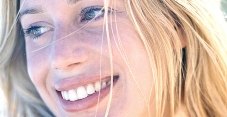 sbiancamento-dentale-studio dentistico angelini a grosseto