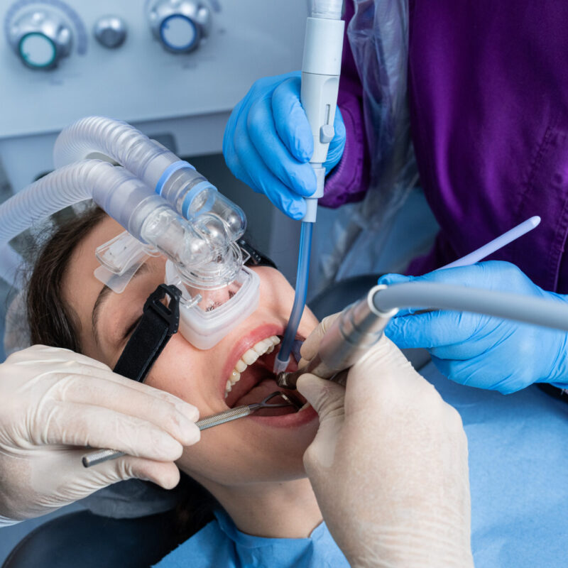 sedazione_angelini_24-0098